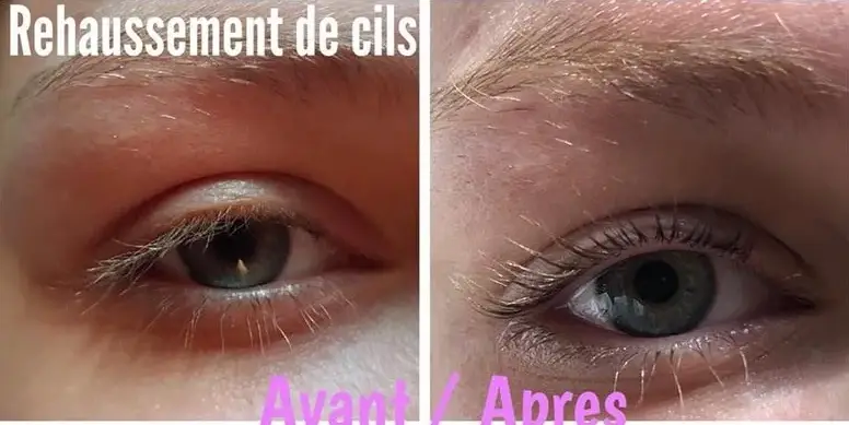 avant apres cils